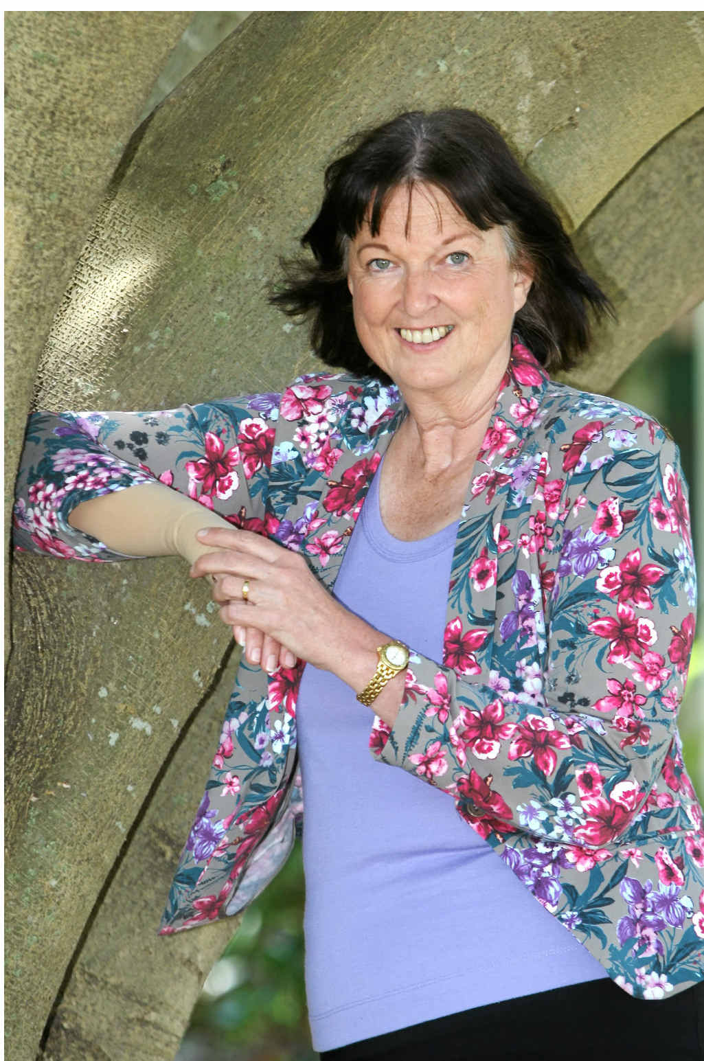 BRAVE STEPS: Cr Jenny McKay talks about new hope for lymphedema sufferers. BRAVE STEPS: Cr Jenny McKay talks about new hope for lymphedema sufferers.