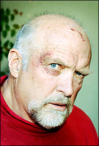 BRAWL BRUISES: Rex Hunt showing the results of last Friday night?s altercation in Byron Bay. One of the youths involved in the BRAWL BRUISES: Rex Hunt showing the results of last Friday night?s altercation in Byron Bay. One of the youths involved in the