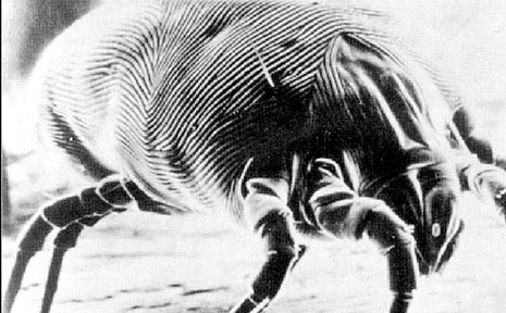 HORROR SHOW: The microscopic house dust mite (enlarged above) is most likely sharing your bed. HORROR SHOW: The microscopic house dust mite (enlarged above) is most likely sharing your bed.
