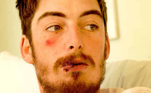 Waterview Heights man Joshua Jones was attacked in Prince Street, Grafton, on Friday night. Waterview Heights man Joshua Jones was attacked in Prince Street, Grafton, on Friday night.