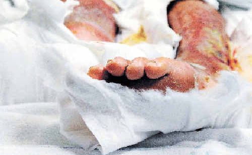 FLESH EATEN: A Ballina man is in Lismore Base Hospital after contracting a flesh-eating bacteria in Prospect Lake, East Ballina. FLESH EATEN: A Ballina man is in Lismore Base Hospital after contracting a flesh-eating bacteria in Prospect Lake, East Ballina.