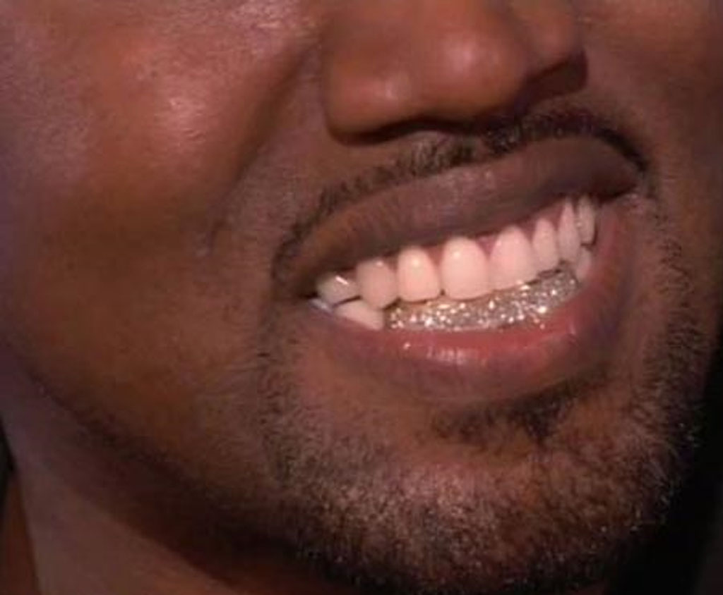 Kanye swaps teeth for diamonds