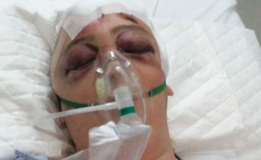 Trent Gardner, son of GJ Gardner founder Greg Gardner, was left in hospital after a shocking crash on an overseas holiday Trent Gardner, son of GJ Gardner founder Greg Gardner, was left in hospital after a shocking crash on an overseas holiday