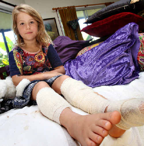 Mia Merlini is recovering well from a suspected shark attack. Mia Merlini is recovering well from a suspected shark attack.