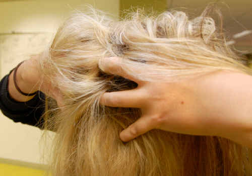 Head lice are getting harder to kill. Head lice are getting harder to kill.
