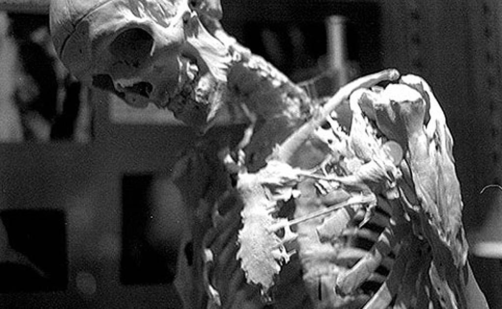 Mutter Museum of medical oddities in Philadelphia. Mutter Museum of medical oddities in Philadelphia.