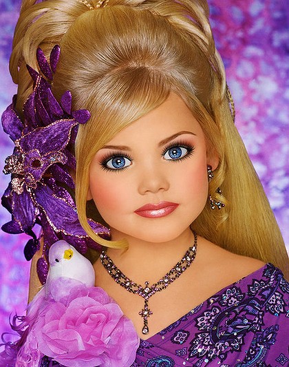 Vanity Unfair For Botox Kids Chronicle