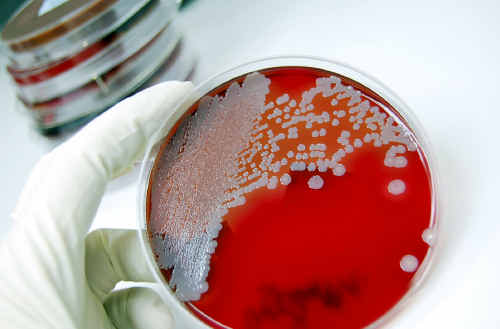 Virus keeps Fraser Coast aged care home in lockdown