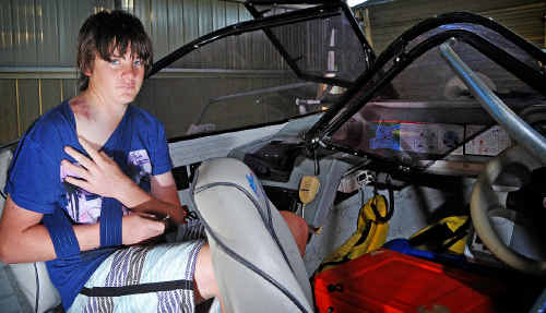 Thirteen-year-old Drew Hall nurses his broken collar bone and bruises yesterday after being struck by a whale’s tail while fishing in the ocean north of Brooms Head. Thirteen-year-old Drew Hall nurses his broken collar bone and bruises yesterday after being struck by a whale’s tail while fishing in the ocean north of Brooms Head.