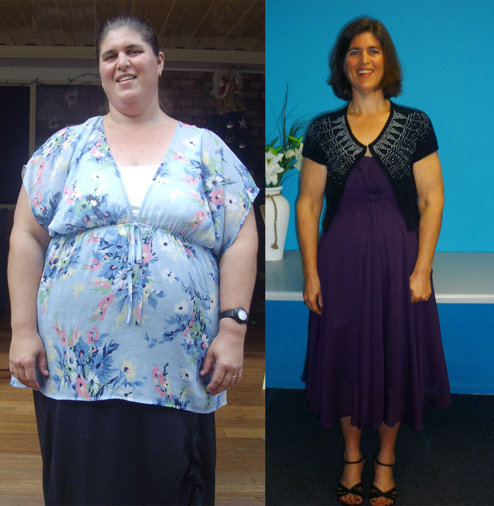 Sandra Beutel before and after she lost 66kg. Sandra Beutel before and after she lost 66kg.