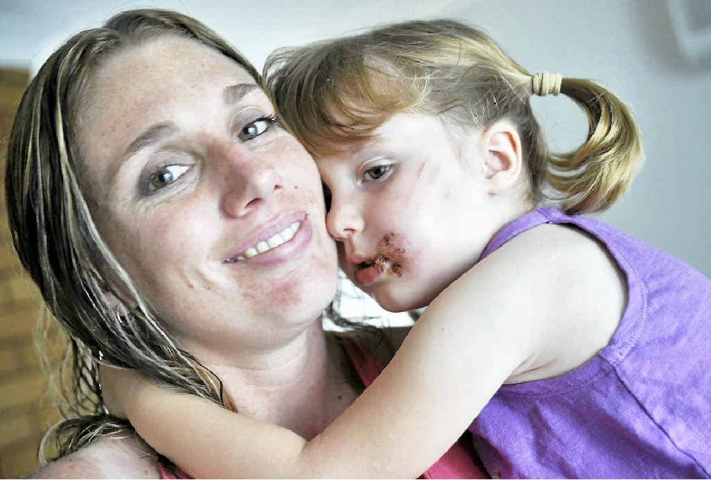 DEMAND FOR ANSWERS: Kellie Trew with daughter Aleeah Boase, 3, who was attacked by a dog in Tannum Sands. DEMAND FOR ANSWERS: Kellie Trew with daughter Aleeah Boase, 3, who was attacked by a dog in Tannum Sands.