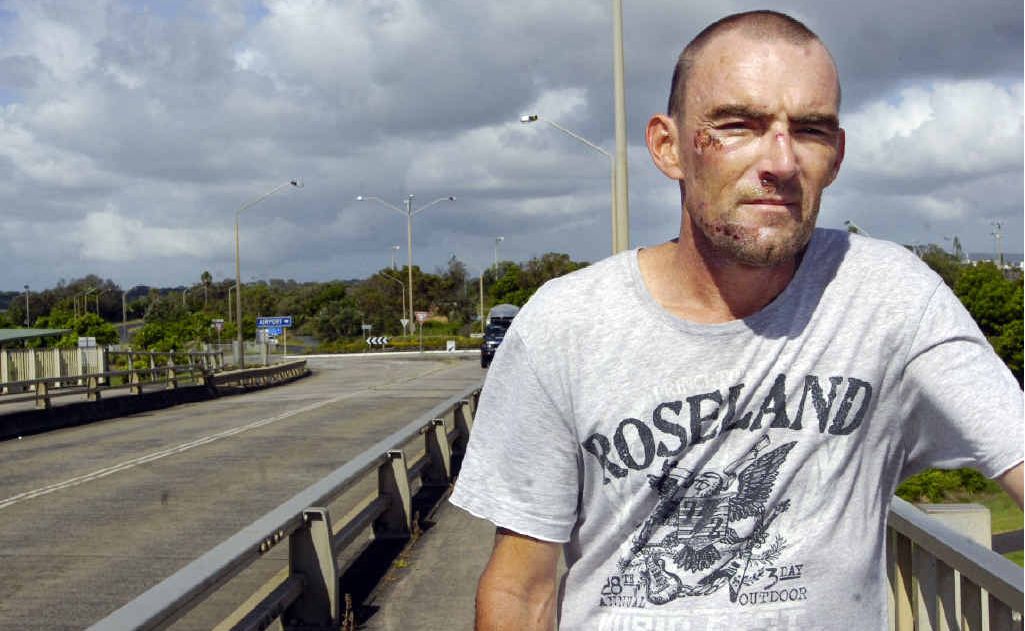 In Ballina, Robbie Moon, who was the victim of skateboard bashing on Missingham bridge, is calling for witnesses to come forward. Mireille Merlet-Shaw In Ballina, Robbie Moon, who was the victim of skateboard bashing on Missingham bridge, is calling for witnesses to come forward. Mireille Merlet-Shaw