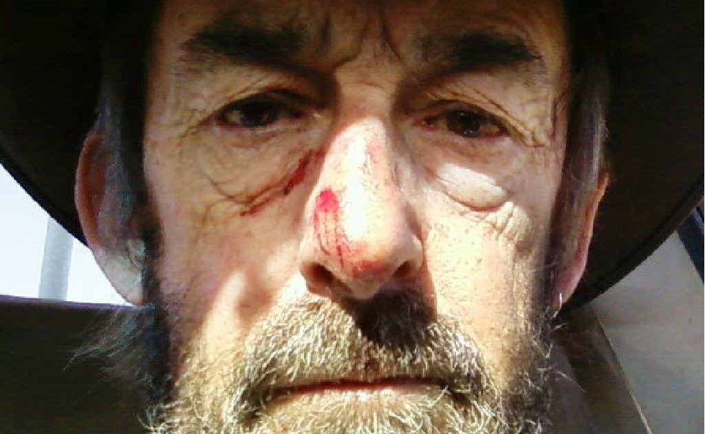 Laurence Martyn was left bloodied and bruised after a mum assaulted him on his school bus run. Laurence Martyn was left bloodied and bruised after a mum assaulted him on his school bus run.