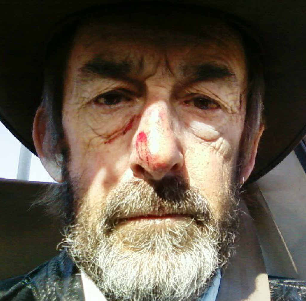 Laurence Martyn was left bloodied and bruised after a mum assaulted him on his school bus run. Laurence Martyn was left bloodied and bruised after a mum assaulted him on his school bus run.