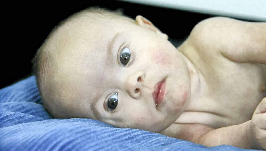 Jahkai Drinkwater has Down syndrome and was born with a variety of health problems. Jahkai Drinkwater has Down syndrome and was born with a variety of health problems.