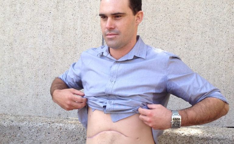 Injured worker Nathan Sandy, 27, fears changes to Queensland's workers' compensation program. Injured worker Nathan Sandy, 27, fears changes to Queensland's workers' compensation program.
