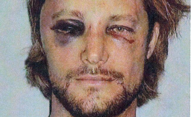 Gabriel Aubry's injuries Gabriel Aubry's injuries