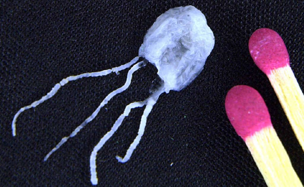 A tiny but fully grown deadly Irukandji jellyfish is placed next to match sticks to provide a size comparison in this photo taken at James Cook University in Cairns. A tiny but fully grown deadly Irukandji jellyfish is placed next to match sticks to provide a size comparison in this photo taken at James Cook University in Cairns.