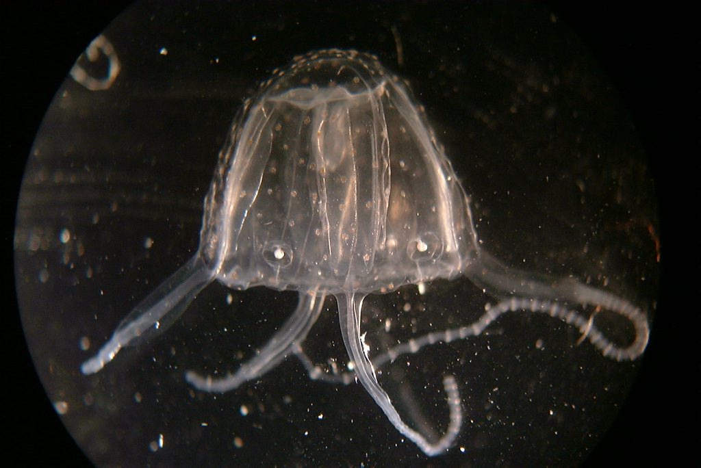 A woman has been transported to hospital with a suspected Irukandji jellyfish sting. A woman has been transported to hospital with a suspected Irukandji jellyfish sting.