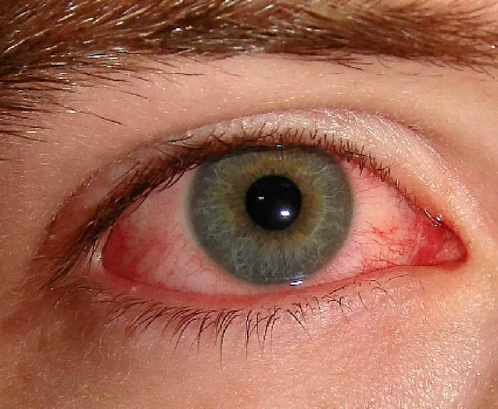 SEEING THINGS: It’s important to protect your eye health says Michelle Peden. SEEING THINGS: It’s important to protect your eye health says Michelle Peden.