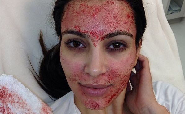 Kim Kardashian after a Kim Kardashian after a