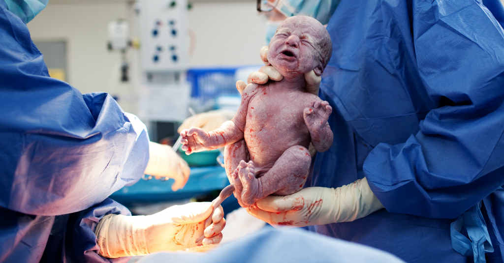 Caesarean rates in Warwick are lower than the national average, with about 28% of deliveries carried out surgically. Caesarean rates in Warwick are lower than the national average, with about 28% of deliveries carried out surgically.