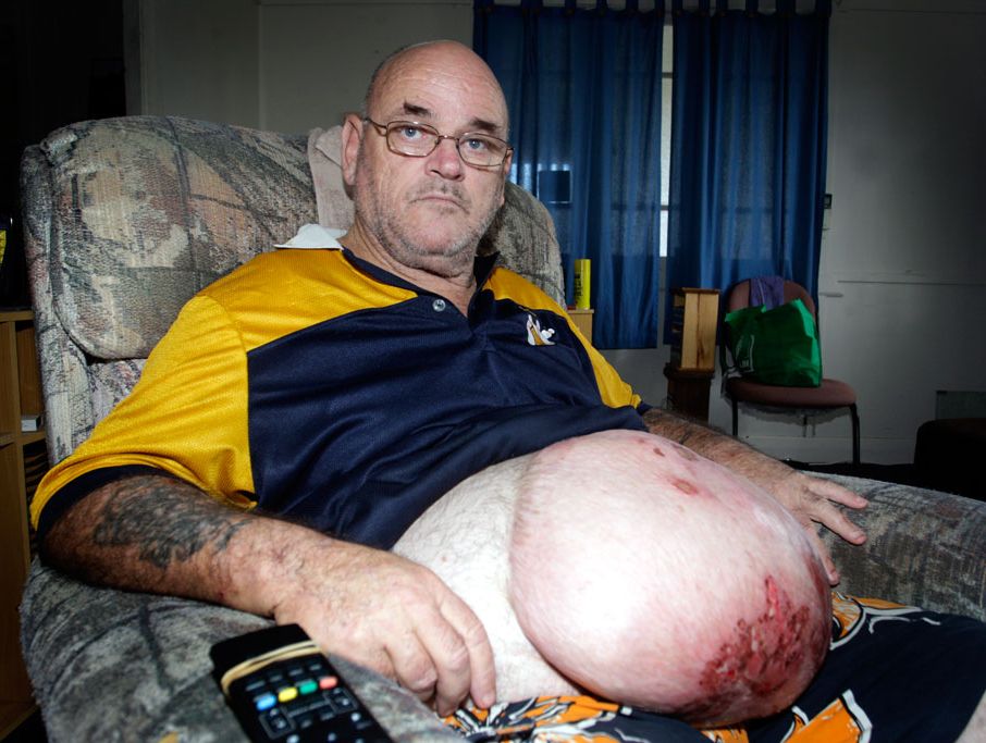 John MacDonald says he faces six operations. John MacDonald says he faces six operations.