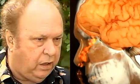 The clear liquid in Joe Nagy's nostrils was in fact protective fluid dripping through a rip in the membrane surrounding his brain The clear liquid in Joe Nagy's nostrils was in fact protective fluid dripping through a rip in the membrane surrounding his brain