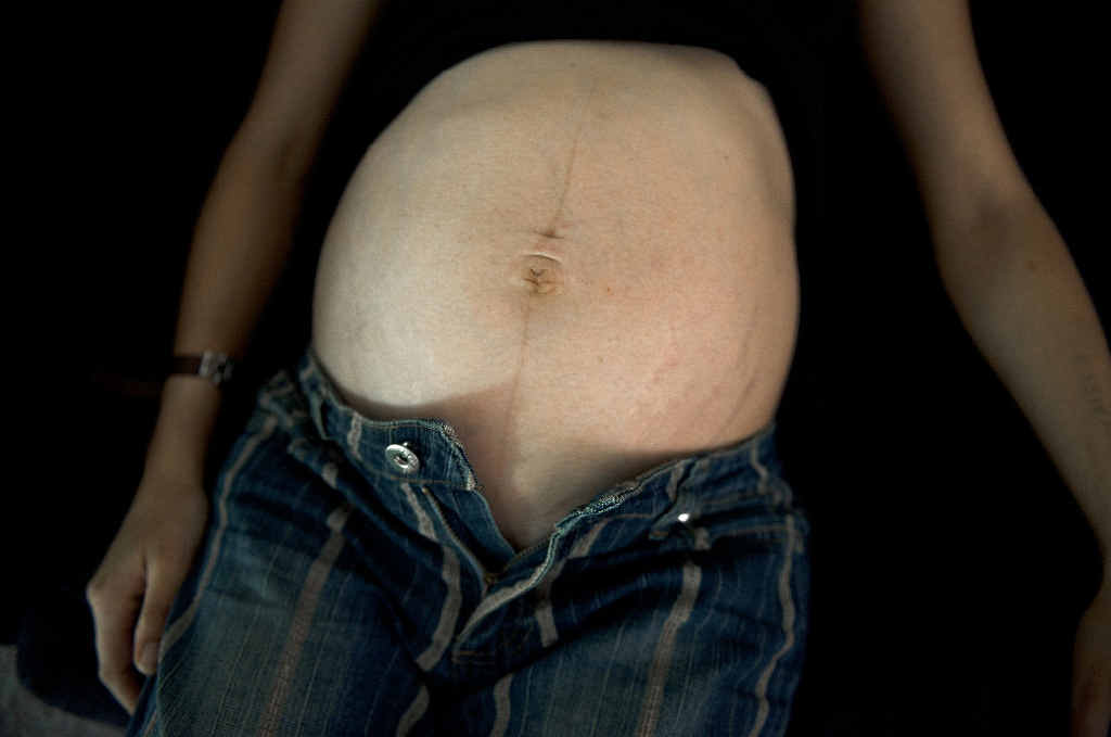 Tamara's pregnant belly. One of the images organisers of the Vivid festival have deemed not Tamara's pregnant belly. One of the images organisers of the Vivid festival have deemed not