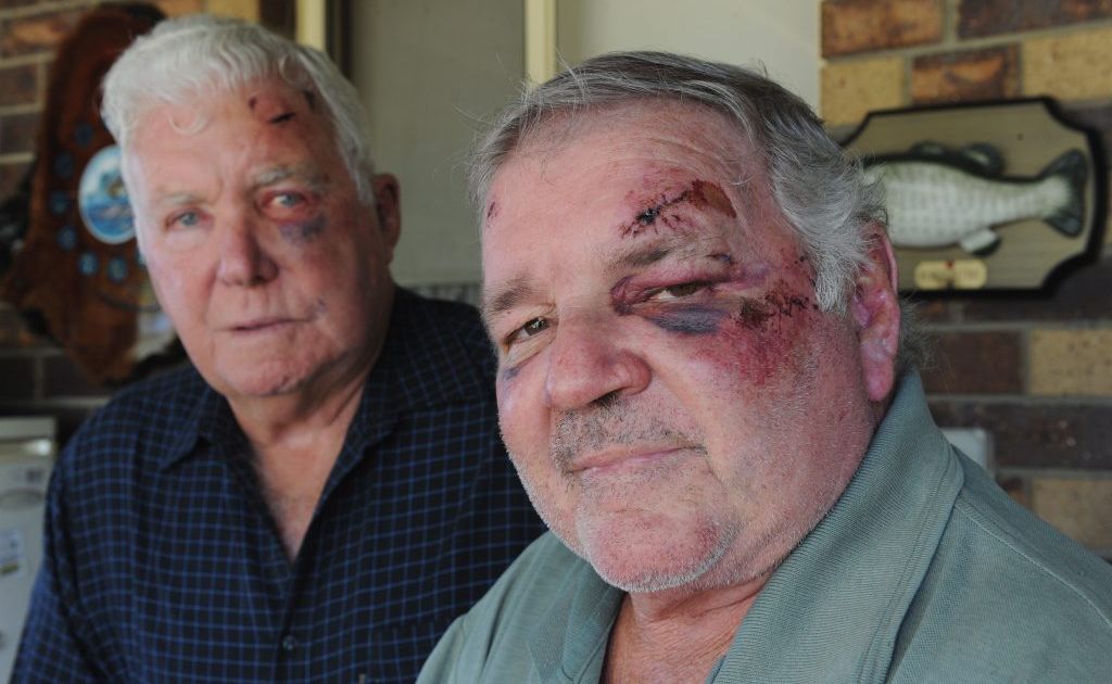 Bashing victims (left) Terry White,73, and Graham Law,64, with injuries they received from being bashed at a hotel in Brisbane. Bashing victims (left) Terry White,73, and Graham Law,64, with injuries they received from being bashed at a hotel in Brisbane.