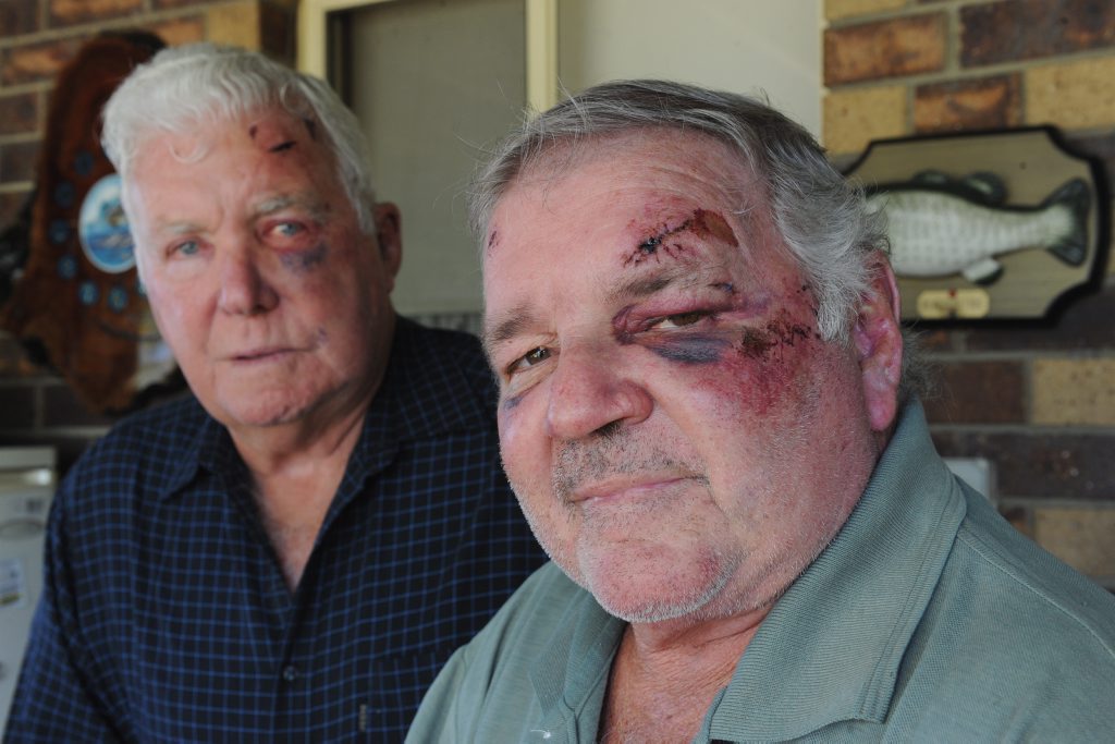 Bashing victims (left) Terry White,73, and Graham Law,64, with injuries they received from being bashed at a hotel in Brisbane. Bashing victims (left) Terry White,73, and Graham Law,64, with injuries they received from being bashed at a hotel in Brisbane.