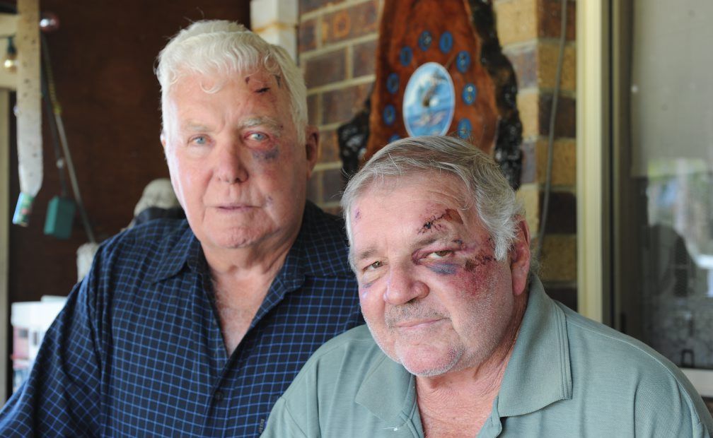 Terry White,73, and Graham Law,64, show some of the injuries they received during the alleged bashing at a hotel in Brisbane. Terry White,73, and Graham Law,64, show some of the injuries they received during the alleged bashing at a hotel in Brisbane.