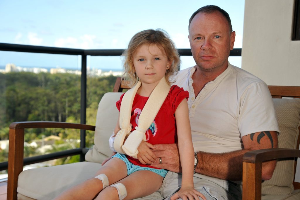Chelsea Fletcher, 5, with dad Howard, of Buderim, was hit by a cyclist at Mooloolaba and suffered a broken collar bone, multiple abrasions, a cut head, cut knees, cut elbows, cut ankle, tyre marks on her back and bruising. Photo: Iain Curry / Sunshine Coast Daily Chelsea Fletcher, 5, with dad Howard, of Buderim, was hit by a cyclist at Mooloolaba and suffered a broken collar bone, multiple abrasions, a cut head, cut knees, cut elbows, cut ankle, tyre marks on her back and bruising. Photo: Iain Curry / Sunshine Coast Daily