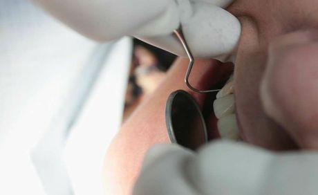 Chronic gum disease can cause tooth loss Chronic gum disease can cause tooth loss