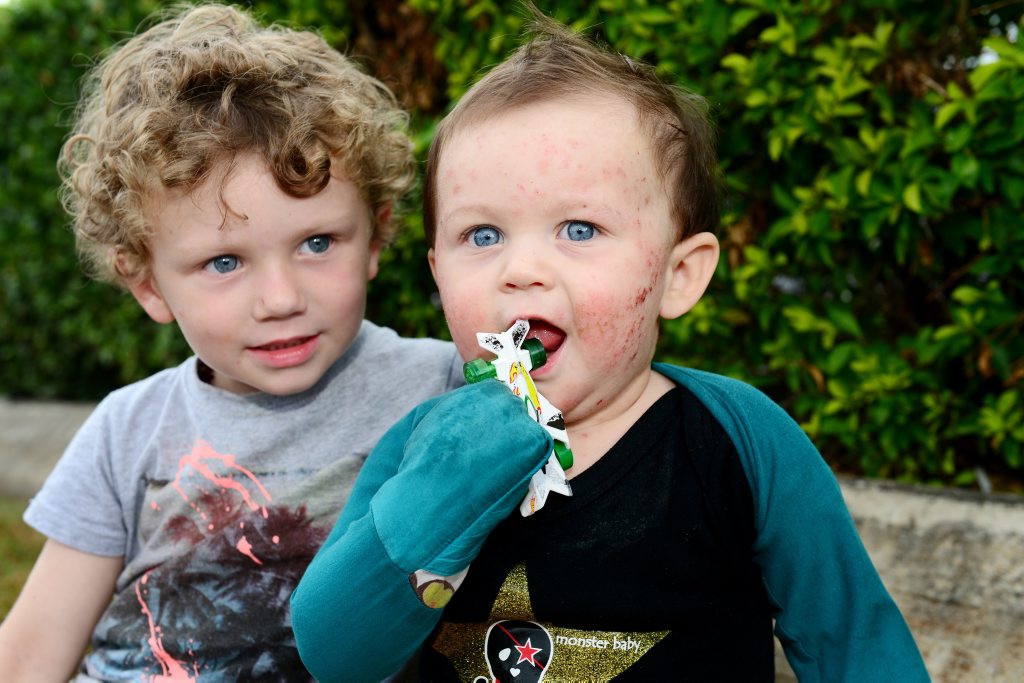 Hunta Breingan, age 3 and his brother Vann Breingan, age 13m, who battles with eczema. Photo Sharyn O'Neill / The Morning Bulletin Hunta Breingan, age 3 and his brother Vann Breingan, age 13m, who battles with eczema. Photo Sharyn O'Neill / The Morning Bulletin