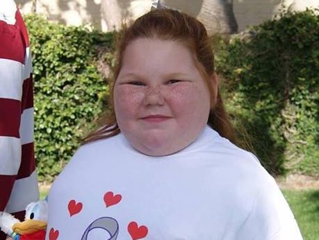 Alexis Shapiro, 12, developed hypothalamic obesity after an operation two years ago. Alexis Shapiro, 12, developed hypothalamic obesity after an operation two years ago.