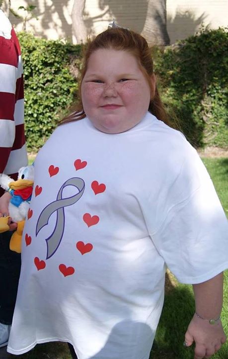 Alexis Shapiro, 12, developed hypothalamic obesity after an operation two years ago. Alexis Shapiro, 12, developed hypothalamic obesity after an operation two years ago.