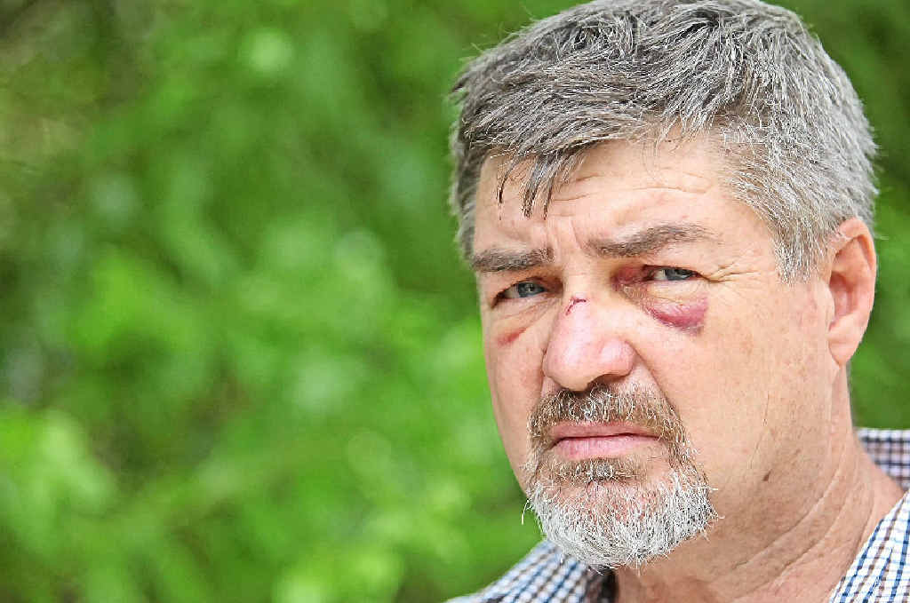 Russell Collins was headbutted at a Sunshine Coast service station in the middle of the day. Russell Collins was headbutted at a Sunshine Coast service station in the middle of the day.