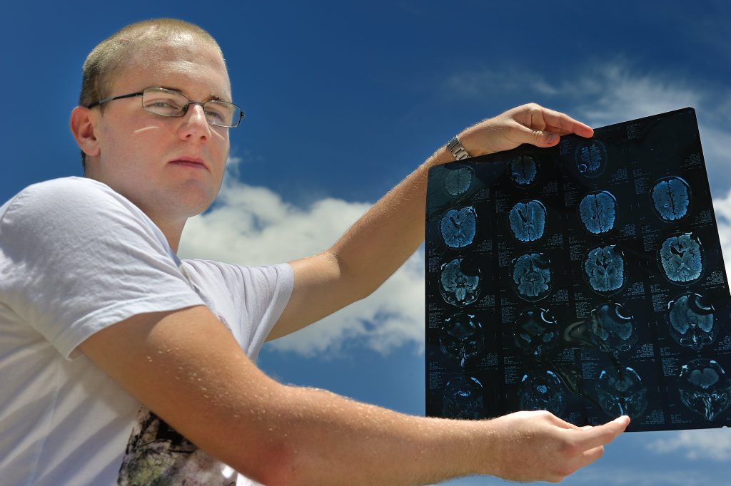 Hydrocephalus sufferer Ben Valery, 18, holds up one of the many CAT scan x-rays that have been carried out on his brain. Hydrocephalus sufferer Ben Valery, 18, holds up one of the many CAT scan x-rays that have been carried out on his brain.