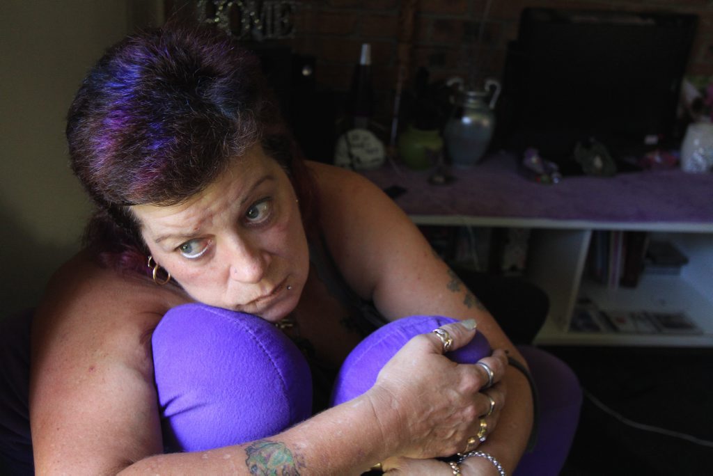 Zoe Tapply has been unable to sleep since a nerve in her mouth became exposed during an emergency dental visit. Zoe Tapply has been unable to sleep since a nerve in her mouth became exposed during an emergency dental visit.