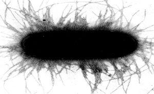E. coli ST131 means urinary tract and bloodstream infections could become more common and difficult to treat. E. coli ST131 means urinary tract and bloodstream infections could become more common and difficult to treat.