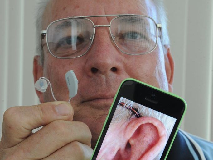 Rick Brown with his new hearing aids which he controls with an app on his iPhone. Rick Brown with his new hearing aids which he controls with an app on his iPhone.