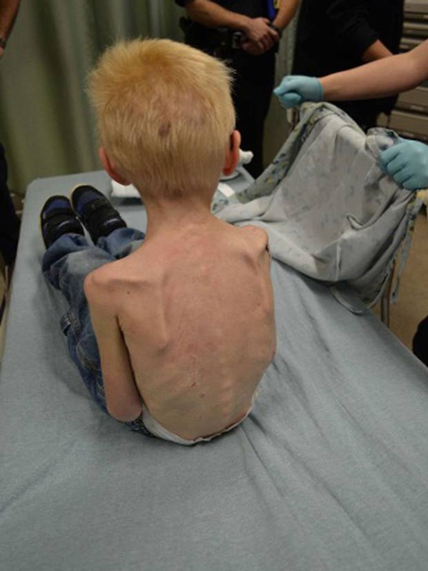 Police released this image of the malnourished, neglected five-year-old boy. Police released this image of the malnourished, neglected five-year-old boy.