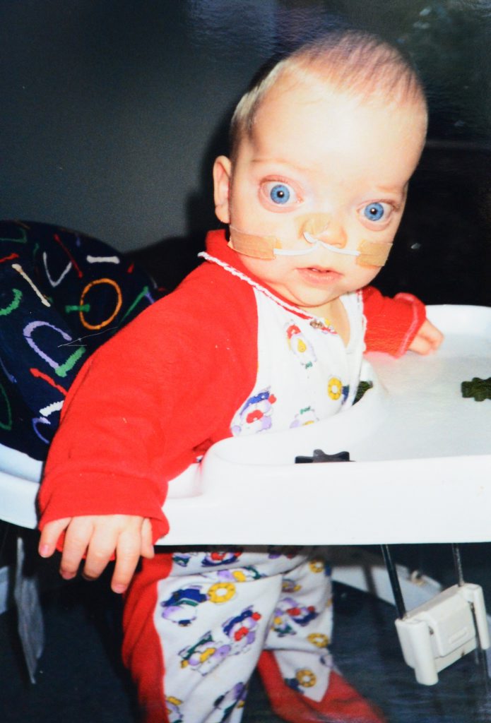 Matthew Barnes, as a baby. He has pfeiffer syndrome. Photo Contributed Matthew Barnes, as a baby. He has pfeiffer syndrome. Photo Contributed