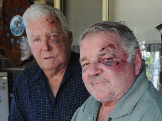 Bashing victims Terry White, 73, and Graham Law, 64, with some of the injuries they received from being bashed outside a Brisbane hotel. Bashing victims Terry White, 73, and Graham Law, 64, with some of the injuries they received from being bashed outside a Brisbane hotel.