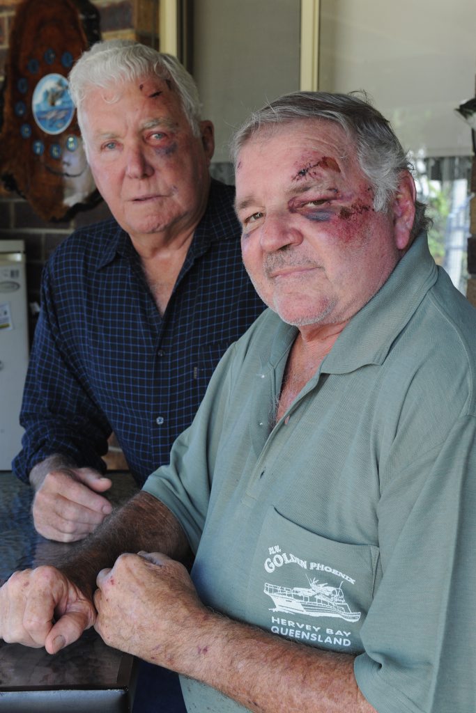 Bashing victims Terry White, 73, and Graham Law, 64, with some of the injuries they received from being bashed outside a Brisbane hotel. Bashing victims Terry White, 73, and Graham Law, 64, with some of the injuries they received from being bashed outside a Brisbane hotel.