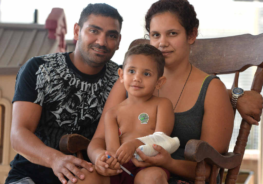 Domenick Lawayne Rupena, 2, with his parents Domenick Rupena and Reannah Mitchell, recovers at Mackay Base Hospital after being bitten by a brown snake. Domenick Lawayne Rupena, 2, with his parents Domenick Rupena and Reannah Mitchell, recovers at Mackay Base Hospital after being bitten by a brown snake.