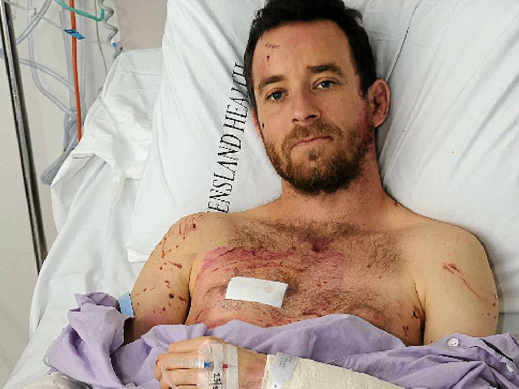 LUCKY ESCAPE: Timo Fuchs in Nambour General Hospital after suffering a horrific dog attack leaving him with a broken leg and multiple lacerations and bruises. LUCKY ESCAPE: Timo Fuchs in Nambour General Hospital after suffering a horrific dog attack leaving him with a broken leg and multiple lacerations and bruises.