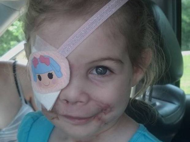 KFC has 'launched an investigation' after claim by family that 3-year-old Victoria Wilcher, who had been mauled by three pit bulls, was forced to leave one of the chain's restaurants. KFC has 'launched an investigation' after claim by family that 3-year-old Victoria Wilcher, who had been mauled by three pit bulls, was forced to leave one of the chain's restaurants.