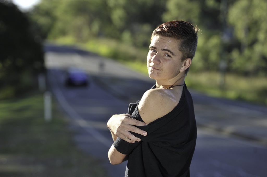 Gladstone teen Matt Bonney has several deep scars after a skateboard accident. Gladstone teen Matt Bonney has several deep scars after a skateboard accident.